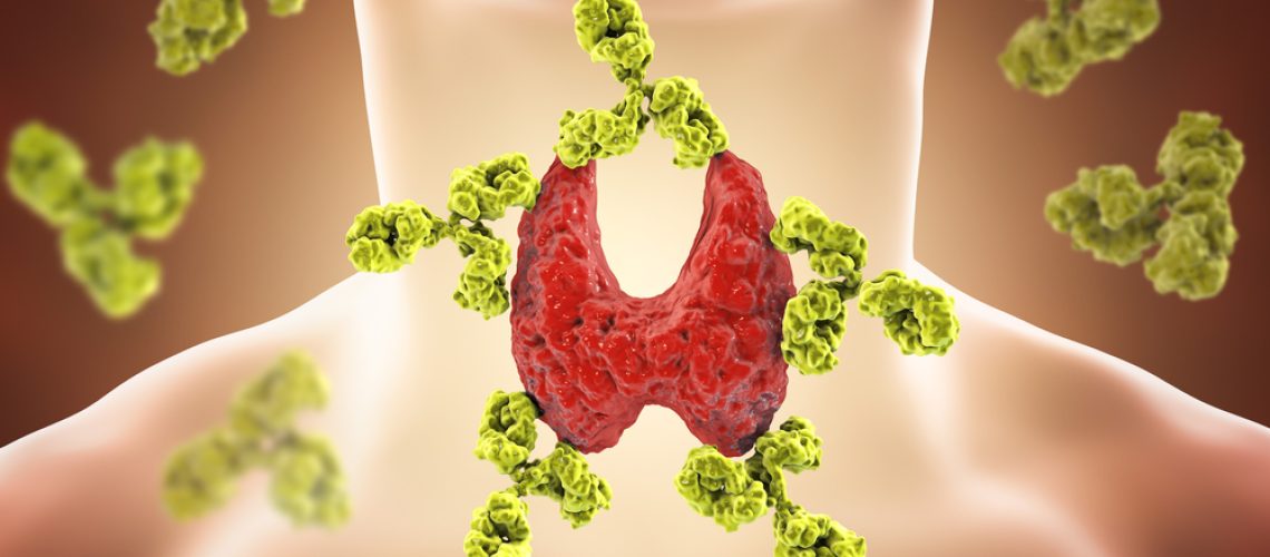 tireoide